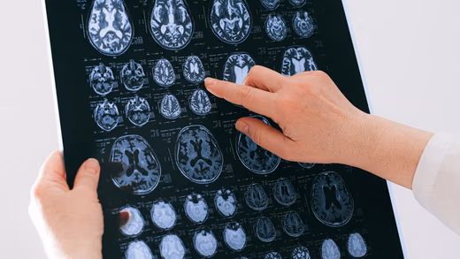 Abstract close-up of glowing neural pathways in a stylised human brain illustration.